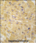 ILK1/ILK2 Antibody (N-term)